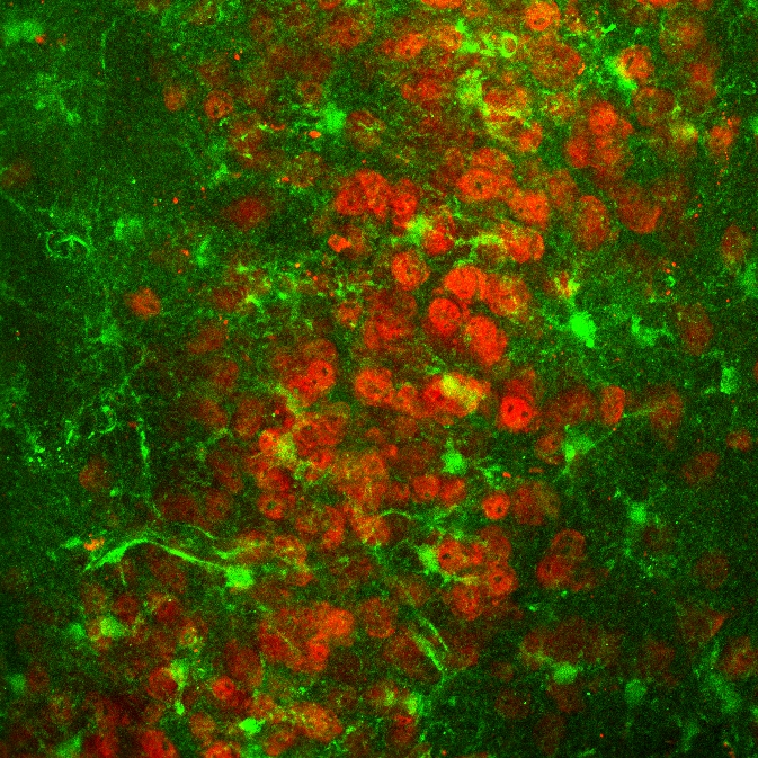 Astrocytes and neurons in the piriform cortex